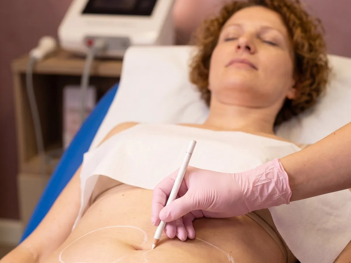Intralipoterapia — trattamento corpo Leda Clinic