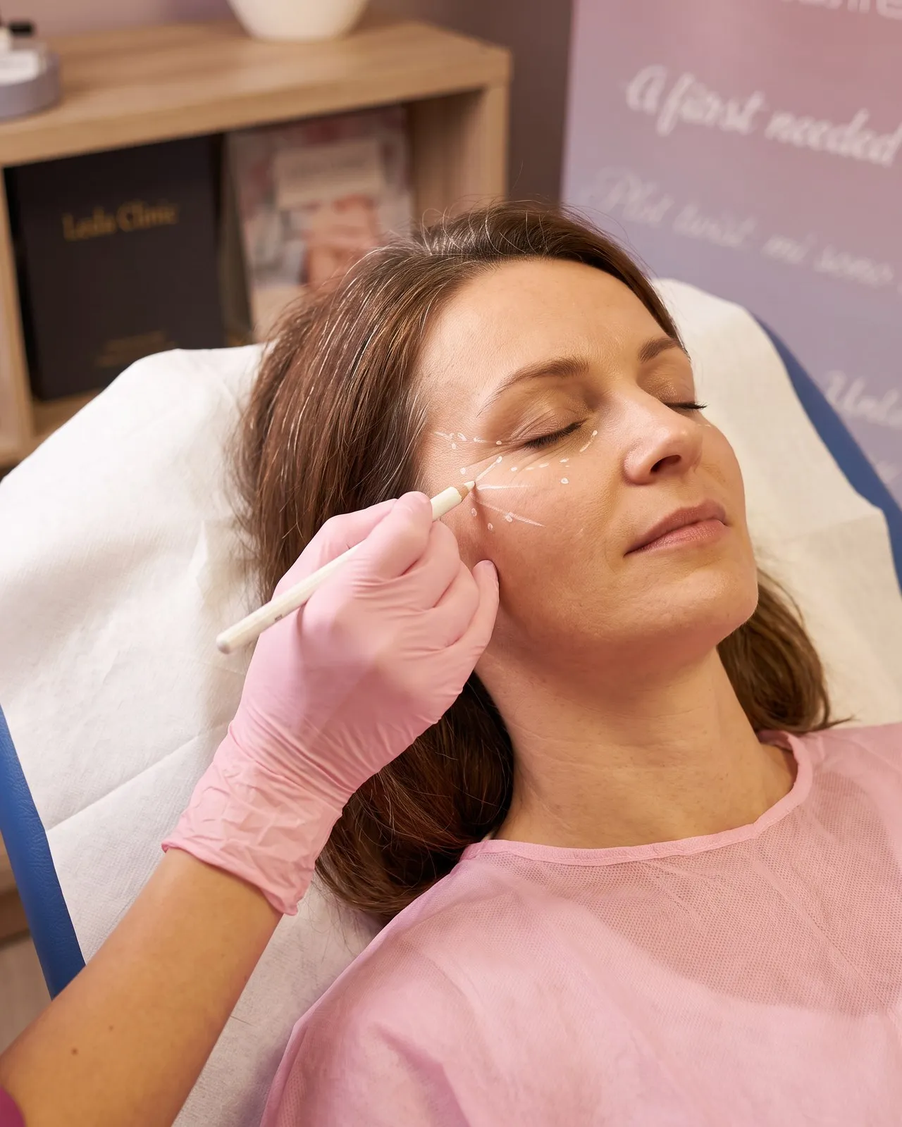 Acido Polilattico — trattamento viso Leda Clinic