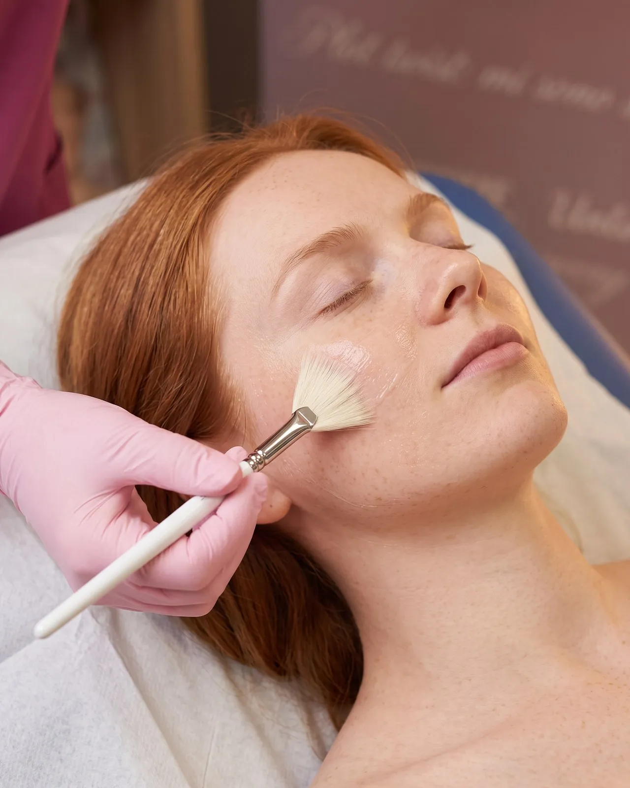 Peeling — trattamento viso Leda Clinic