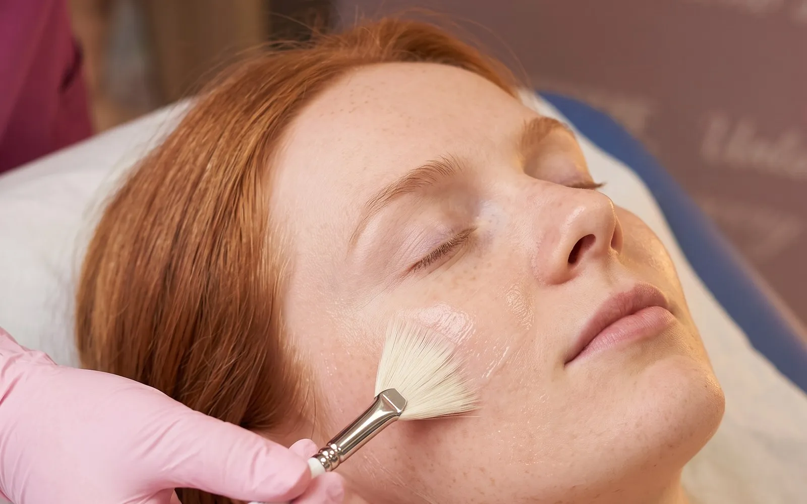 Peeling — trattamento viso Leda Clinic