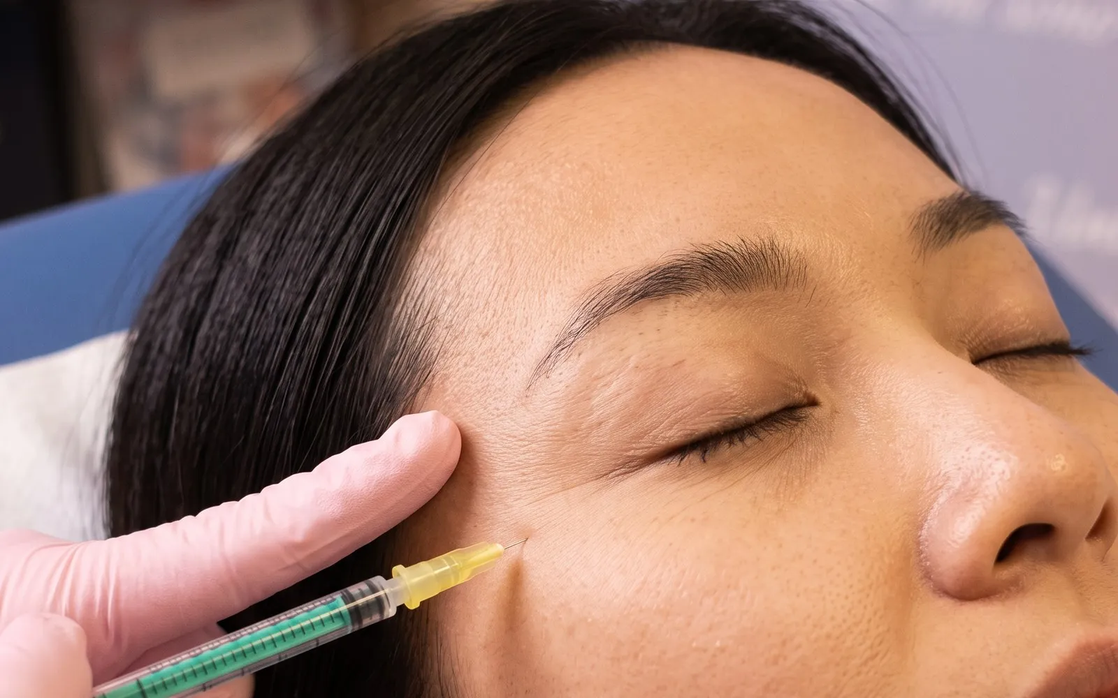 Botulino — trattamento viso Leda Clinic